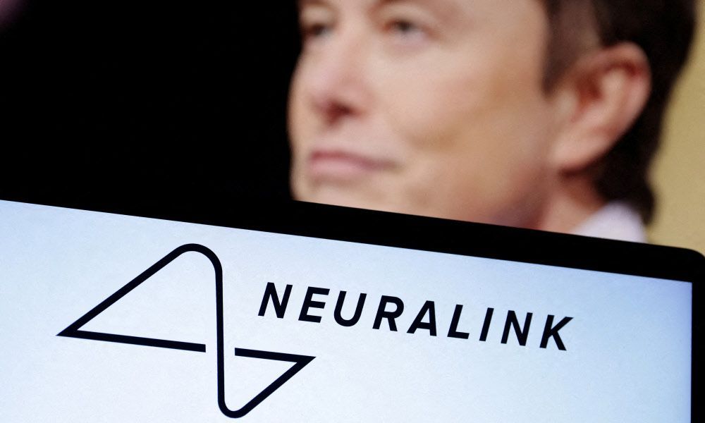 Start-up von Elon Musk implantiert ersten Chip in menschlichem Gehirn